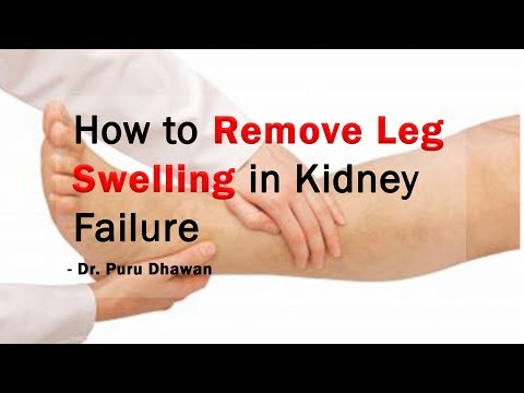 download lagu mp3 mp4 Coffee And Swelling Feet, download lagu Coffee And Swelling Feet gratis, unduh video klip Coffee And Swelling Feet
