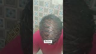 Shocking results of Avimee Herbal Keshpallav Hair Oil & Hairtone PV 1 Scalp Spray #haircare #avimee