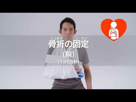 骨折の固定 腕