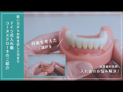 ドイツ式部分入れ歯コーヌスクローネのご紹介〜若い方からお年を召した方まで〜