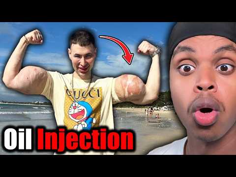 When Looksmaxxing Surgeries Go Wrong..
