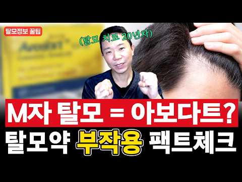 M자 탈모에는 무조건 아보다트가 정답일까요? | 프로페시아와 차이, 갈아타기, 부작용