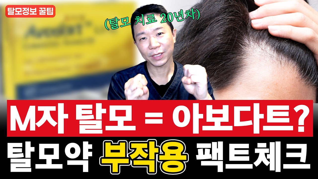 M자 탈모에는 무조건 아보다트가 정답일까요? | 프로페시아와 차이, 갈아타기, 부작용