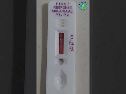 Malaria rapid diagnostic test | Malaria antigen test | Maleria test | plasmodium |MP