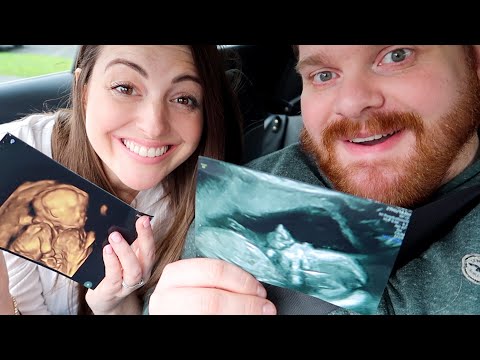 OUR 20 WEEK SCAN! FINDING OUT THE GENDER!