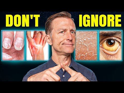 Yellow Bumpy Patches Around the Eyelids