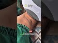 Hayo Siapa Nih Yang Punya Problem Yang Sama Nih Ketiakcerah Ketiakhitam Ketiak Ketiakputih