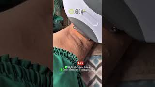 Download lagu Hayo siapa nih yang punya problem yang sama nih?? #ketiakcerah #ketiakhitam #ketiak #ketiakputih mp3