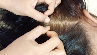 💫✨ ASMR - Scalp Check Tingles (Real Person), Sensitivity Tests, Deep Sleep 😴😴#asmr #tingles #sleep