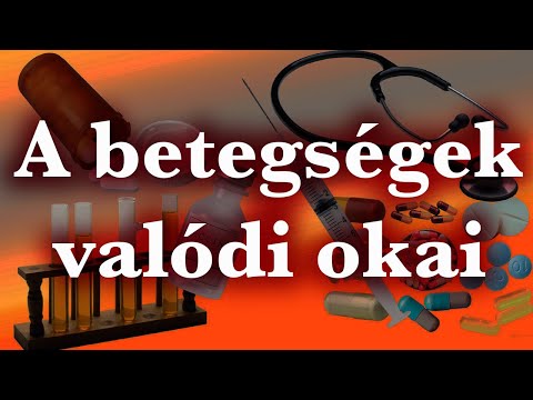 Drága kenőcsök ízületi fájdalmak kezelésére