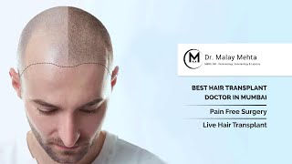 All You Need To Know About Hair Transplant
