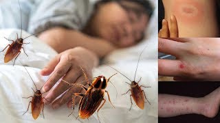 Do Cockroaches Bite? Why Would A Cockroach Bite You?