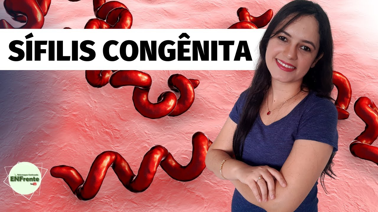 Sífilis Congênita (Profa. Juliana Mello)