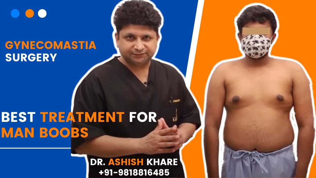 Gynecomastia Surgery in Jhajjar | Best Results