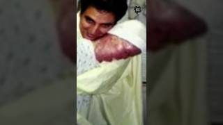 Download lagu UNIVERSITY student who underwent over 120 surgeries after COMPLETELY LOSING her FACE RESTED in peace mp3 Download lagu UNIVERSITY student who underwent over 120 surgeries after COMPLETELY LOSING her FACE RESTED in peace mp3