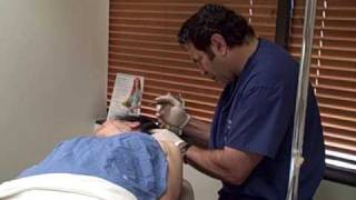 My Facial Plastic Surgery Blog – Day of Surgery