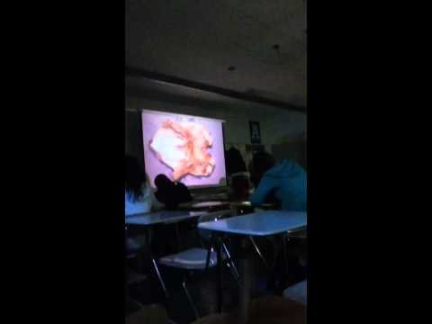 download lagu mp3 mp4 Chicken Carcass Parts, download lagu Chicken Carcass Parts gratis, unduh video klip Chicken Carcass Parts