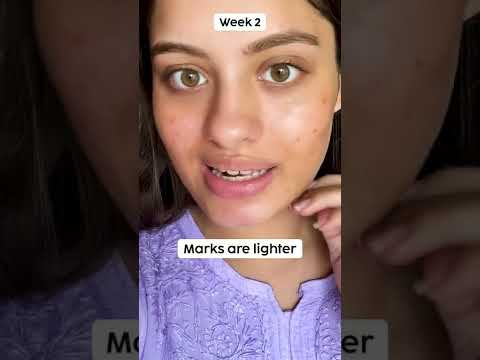 KOJIC ACID FACE SERUM