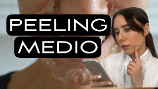 CUIDADOS DESPUÉS DE UN PEELING QUÍMICO MEDIO (JESSNER, RETINOL).