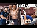 My Gym Partner Got Rhabdomyolysis From Overtraining (Deadly Potentially)