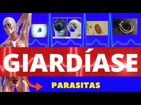 GIARDÍASE - GIARDIA LAMBLIA (GIARDIA) - PARASITOLOGIA /INFECTOLOGIA - (ENSINO SUPERIOR)