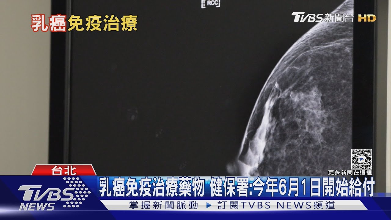 出現「這幾種」狀況.....罹乳癌機率增　醫師警告：年輕化趨勢....不可忽視！