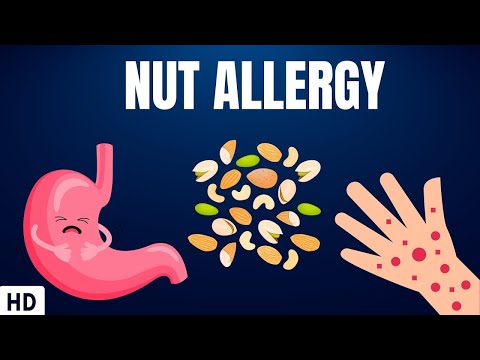 Nut Allergy: Everything You Need To Know