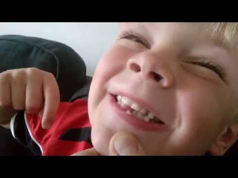 Truputi kliba dantukas Bennys wobbly tooth