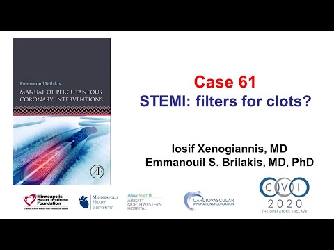 Case 61: PCI Manual - Filter for clots?