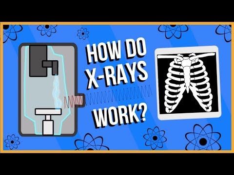 X ray mekar di jiwa