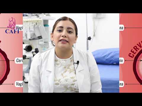 Virus del Papiloma Humano