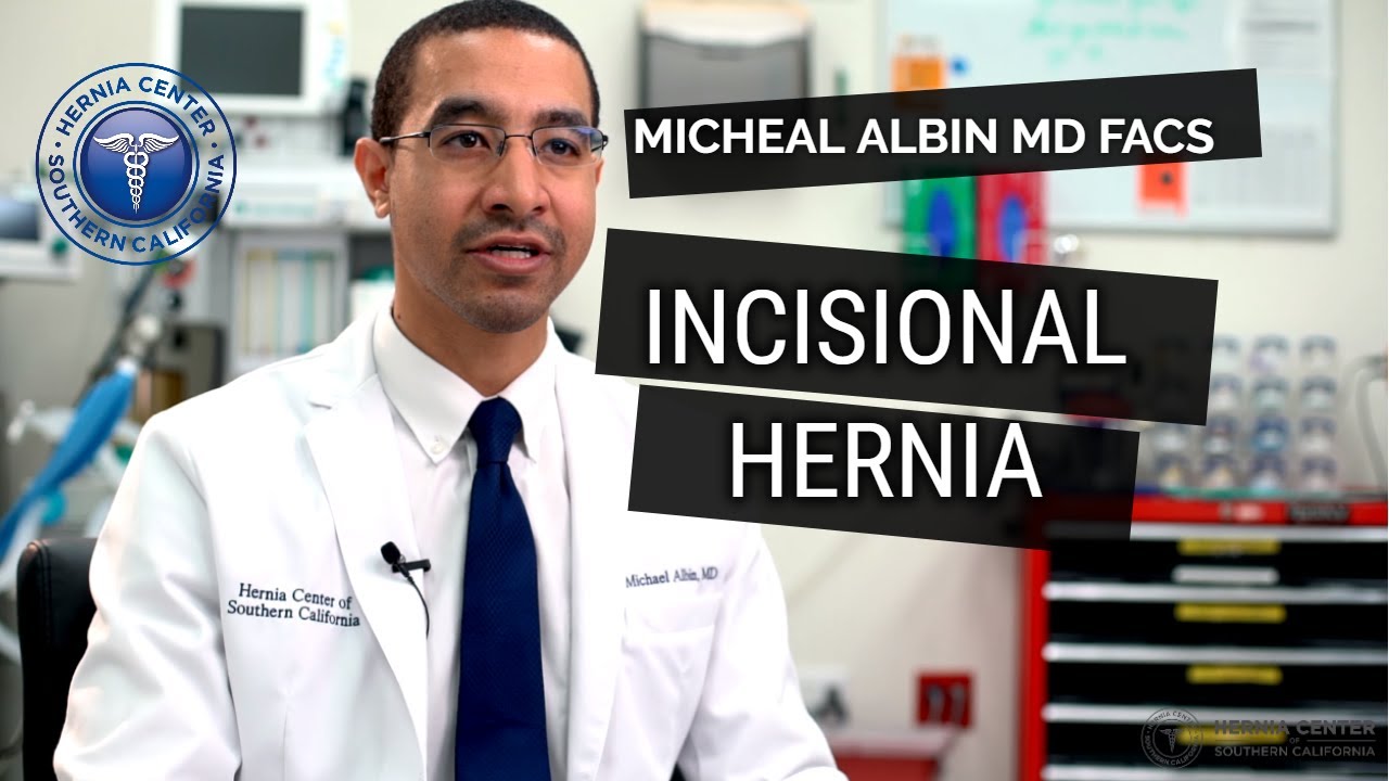 Incisional Hernia: Causes, Symptoms, Diagnosis, Treatment. Explained by Michael Albin, M.D. F.A.C.S