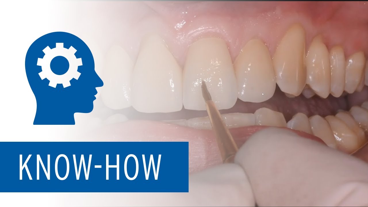 Use of Zolid zirconia in everyday dental practice