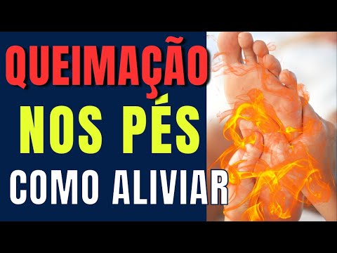 5 Dicas para Acabar com a Queimação nos Pés