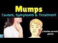 Mumps: Symptoms, Causes, Treatments and Complications