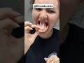 Doctor REVEALS Why She LOST ALL Her Teeth Denturejourney Denturelife Drugaddictionawareness