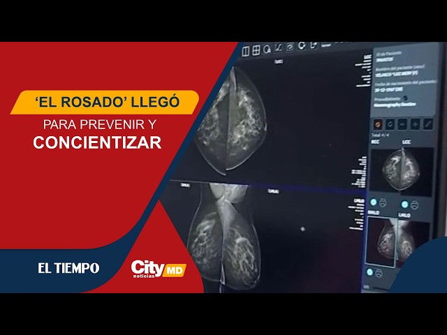 ¿Necesita una mamografía o un examen clínico de mama? Así puede acceder gratis en El Dorado