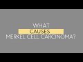 What Causes Merkel Cell Carcinoma