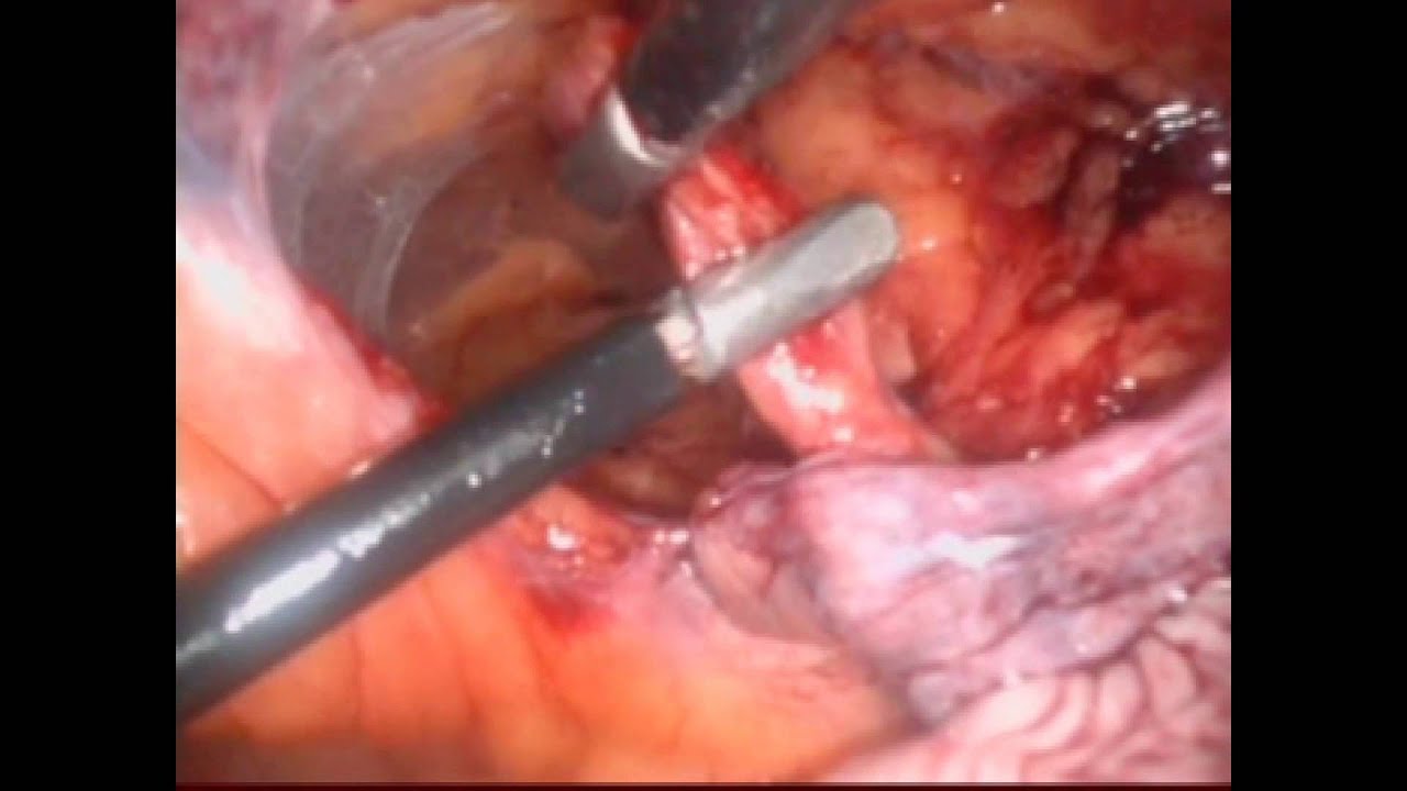 Omar Alvarado Barron-1