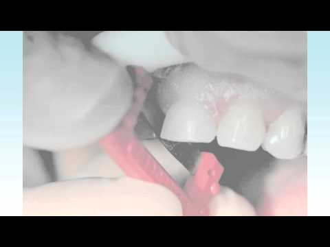 The ContacEZ IPR Strip System