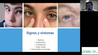 Dacriocistorrinostomia Endoscopica