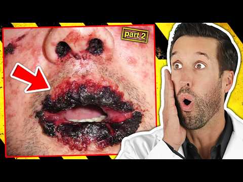 ER Doctor REACTS to World's Deadliest Diseases #2