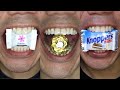 Chocolates ASMR DoctorTristanPeh
