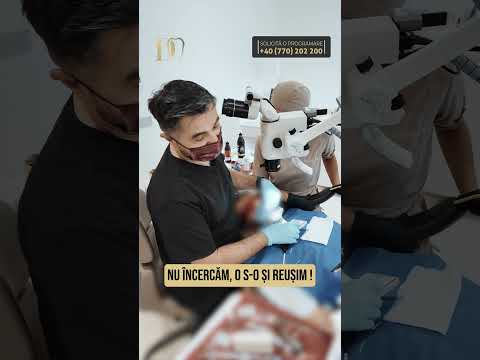 Nu scoatem dintele! Cum poate fi salvat prin tratament endodontic