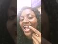 POV: Taking out my last baby tooth as an adult 😭 #toothextractions #dentist  #selfcare
