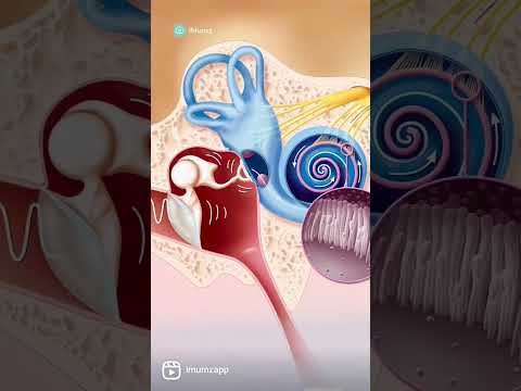 Ear infection in babies? Here's what you need to k ow about it. #baby #parenting #tips #babycare