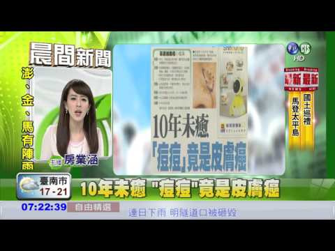 10年未癒 "痘痘"竟是皮膚癌