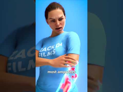 What Is Phantom Limb Pain? 😨