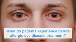 What do patients experience before allergic eye disease treatment?