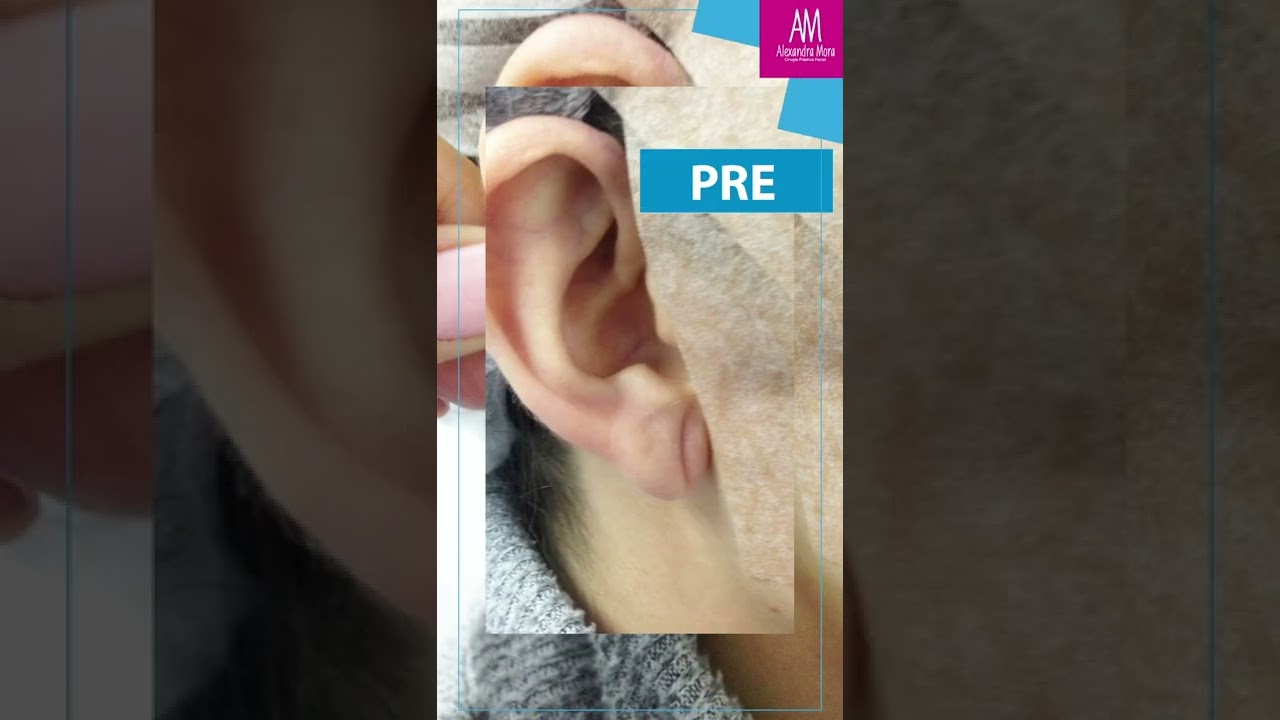 Alexandra Mora Hernandez-137